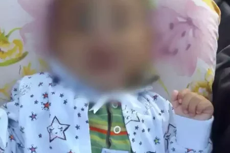 Bebê de 6 meses morre após apresentar hematoma na cabeça e sangramento no nariz